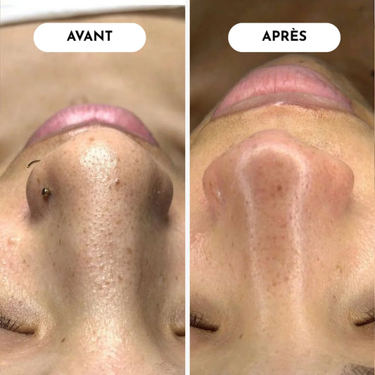 Pack routine point noir