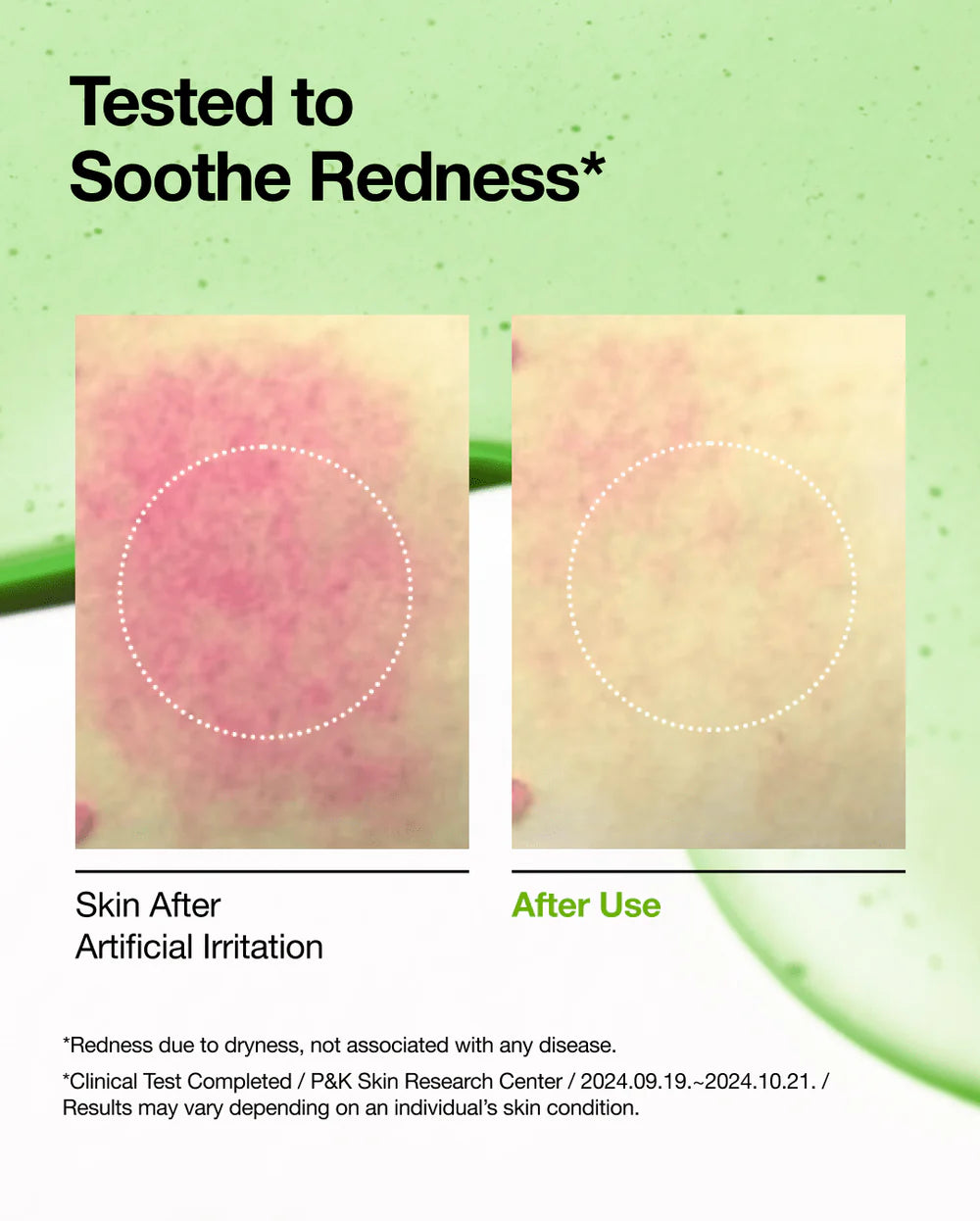 Sérum Apaisant pour Rougeurs à l'Acide Azélaïque 10 et Hyaluron